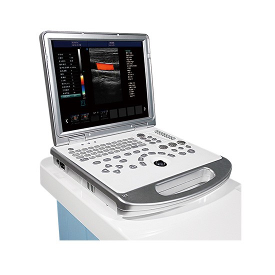 High Clear Imagine Laptop 4D Color Doppler Ultrasound and Scanner System