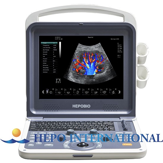 Laptop Clinic 4D Fetal Ultrasonic Imaging Doppler With CW function