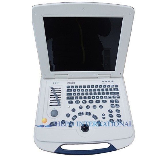 Medical High End White and Black Laptop Ultrasound Scanner