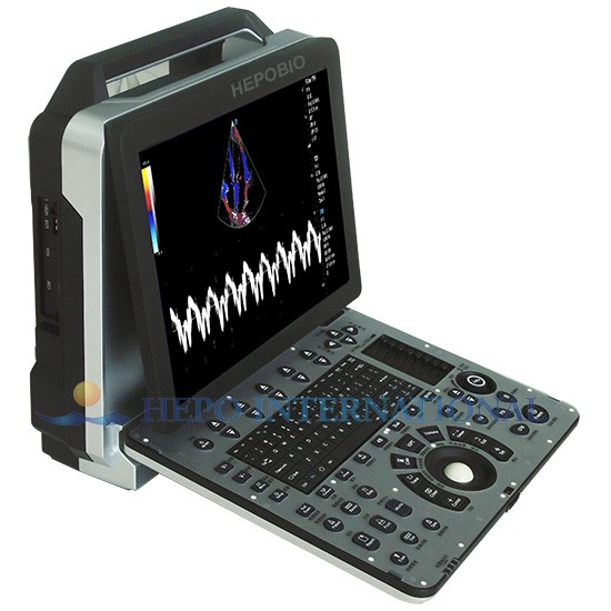 All-purpose Application Color Doppler Ultrasound Diagnostic System
