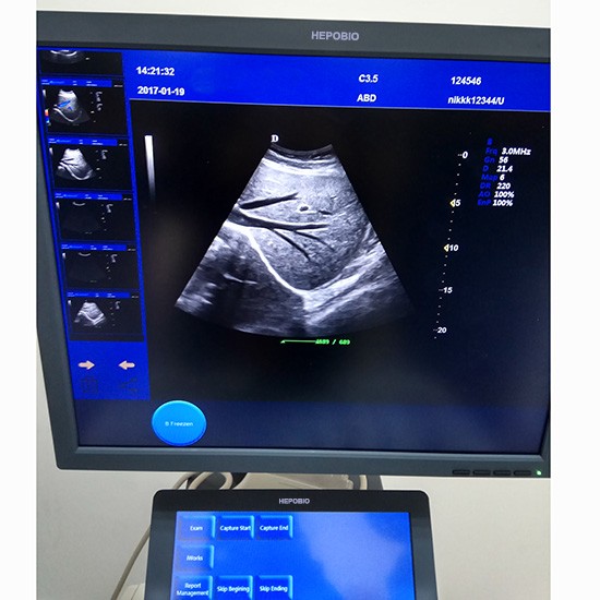 4D Cardiac Fetal Color Ultrasound Doppler Imaging Machine With CW function