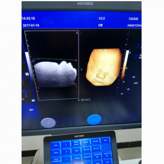 4D Cardiac Fetal Color Ultrasound Doppler Imaging Machine With CW function
